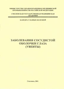 Заболевания сосудистой оболочки глаза (увеиты)
