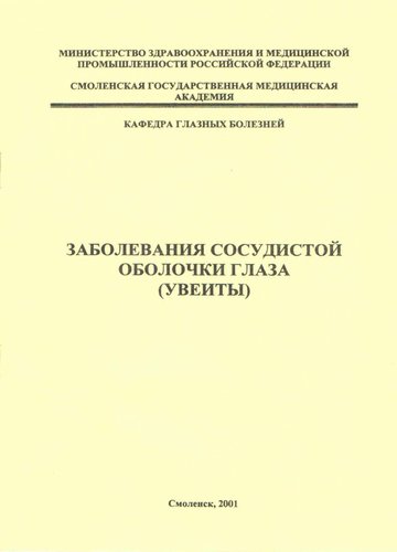 Заболевания сосудистой оболочки глаза (увеиты)