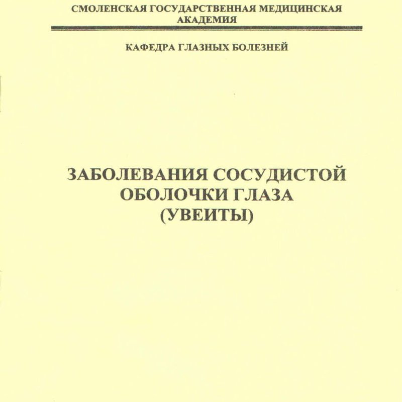 Заболевания сосудистой оболочки глаза (увеиты)
