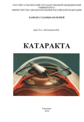 Катаракта 3-е изд. (последний экземпляр)