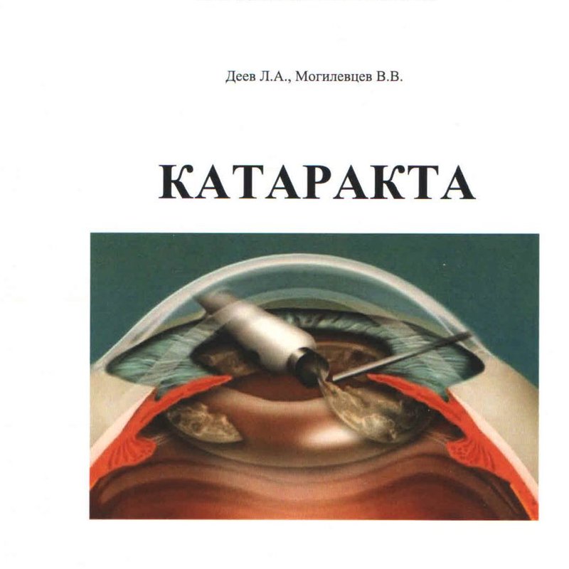 Катаракта 3-е изд. (последний экземпляр)