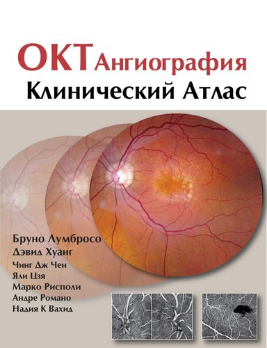 ОКТ-ангиография. Клинический атлас