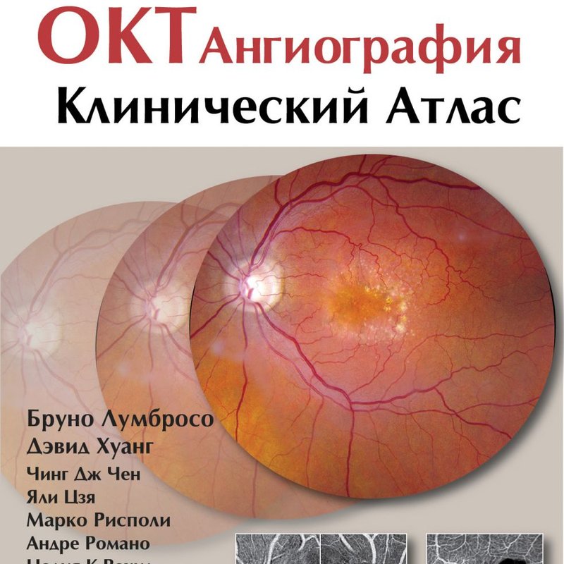 ОКТ-ангиография. Клинический атлас