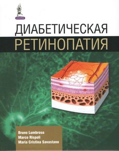 Диабетическая ретинопатия