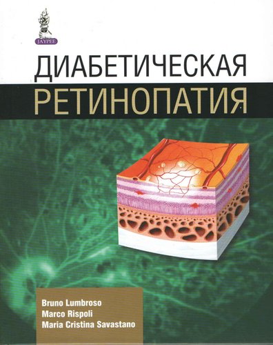 Диабетическая ретинопатия