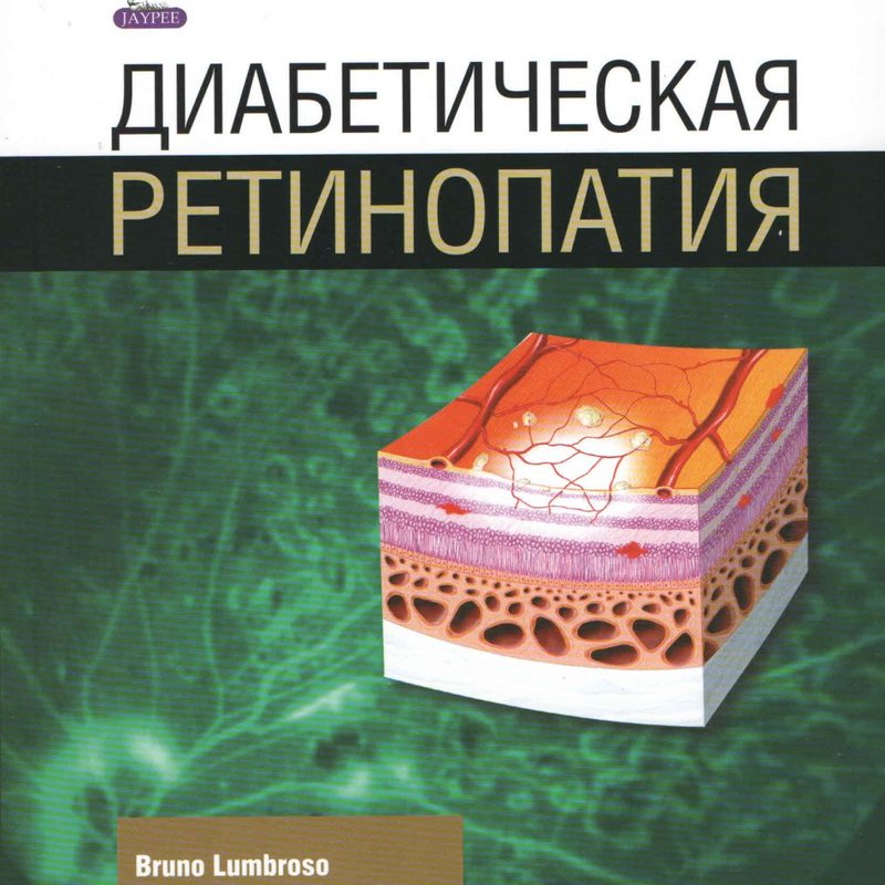 Диабетическая ретинопатия