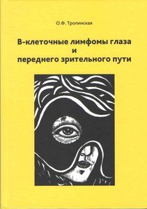 В-клеточные лимфомы глаза и переднего зрительного пути