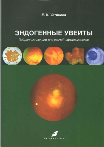 Эндогенные увеиты. Избранные лекции для врачей-офтальмологов