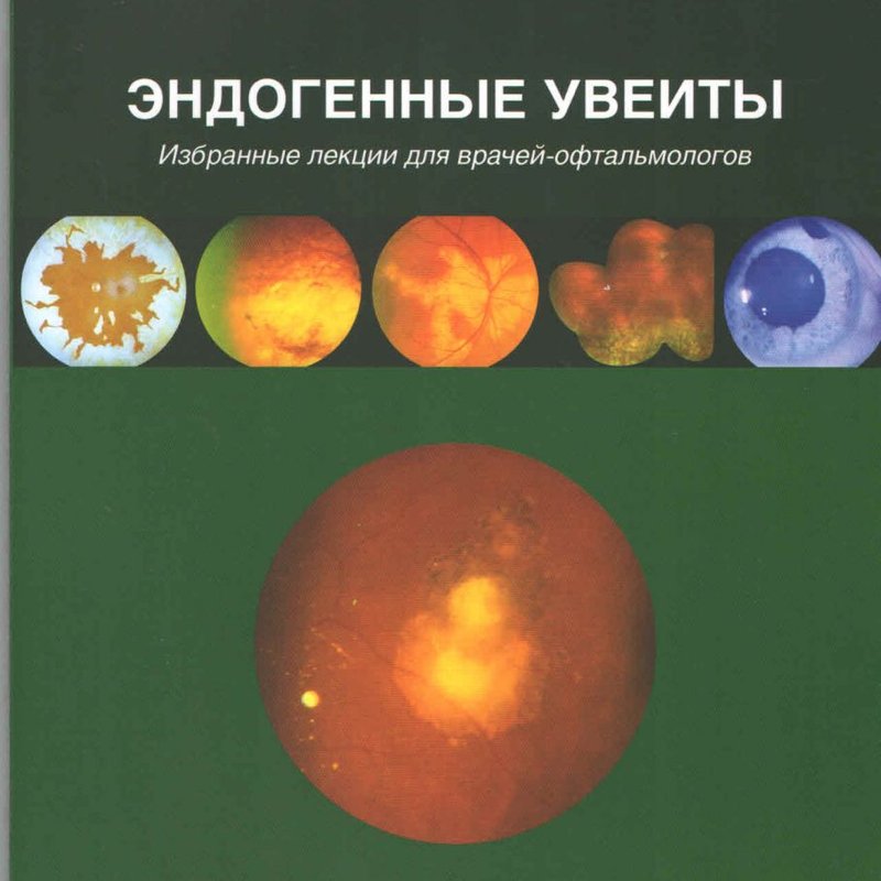Эндогенные увеиты. Избранные лекции для врачей-офтальмологов