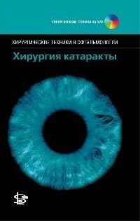Хирургия катаракты