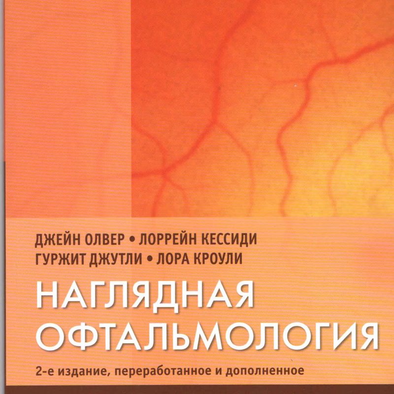 Наглядная офтальмология