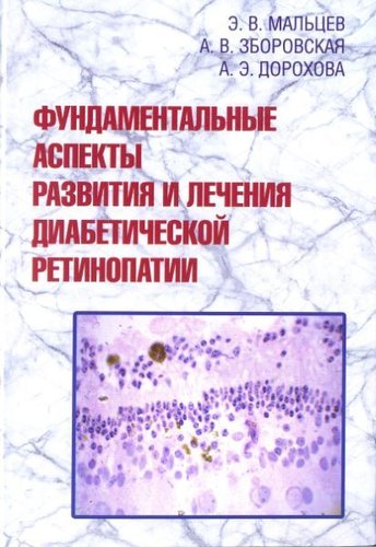 Фундаментальные аспекты развития и лечения диабетической ретинопатии