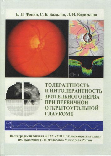 Толерантность и интолерантность зрительного нерва при первичной открытоугольной глаукоме