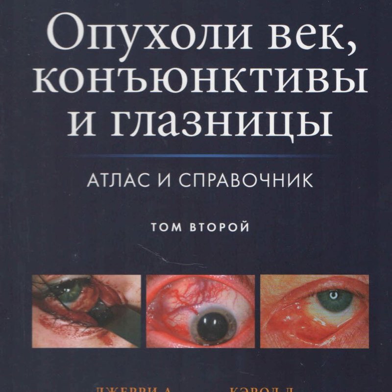 Опухоли век, конъюнктивы и глазницы. В 2-х томах. Том второй