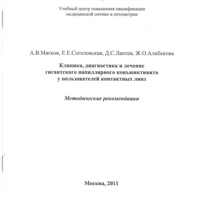 Клиника, диагностика и лечение гигантского папиллярного конъюнкивита у пользователей контактных линз