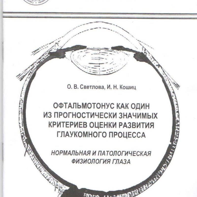 Офтальмотонус как один из прогностически значимых критериев оценки развития глаукомного процесса. Но