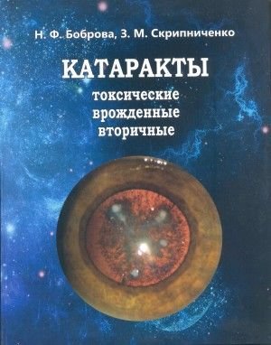 Катаракты - токсические, врожденные, вторичные