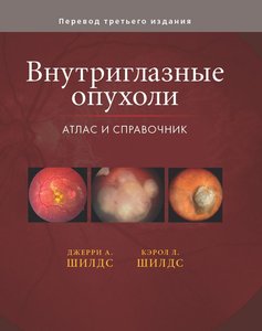Внутриглазные опухоли. Атлас и справочник Том3.