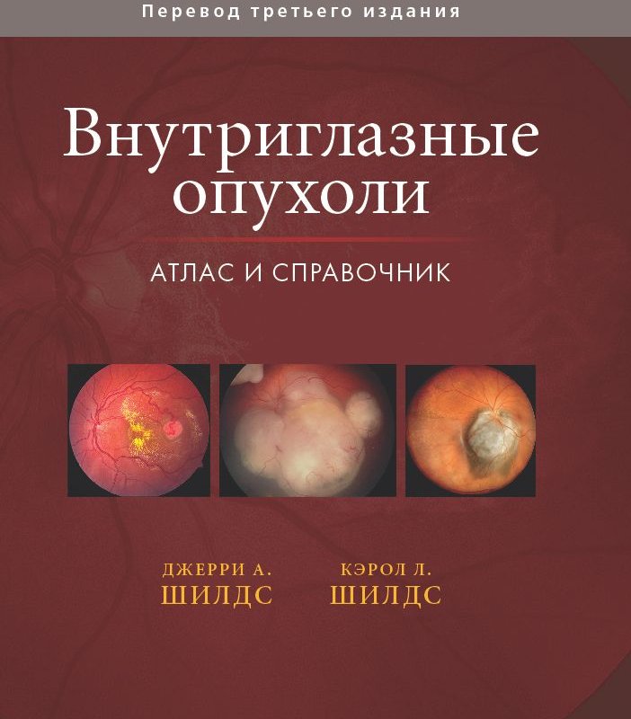 Внутриглазные опухоли. Атлас и справочник Том3.