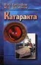 Катаракта