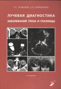 Лучевая диагностика заболеваний глаза и глазницы