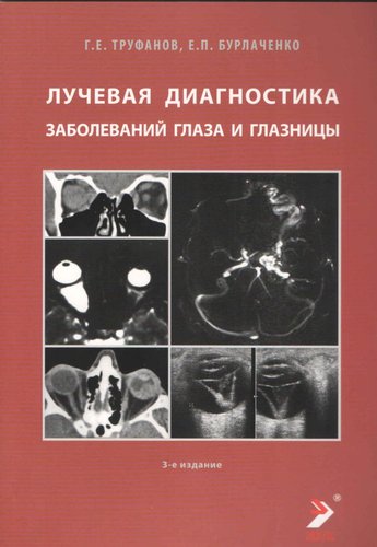 Лучевая диагностика заболеваний глаза и глазницы