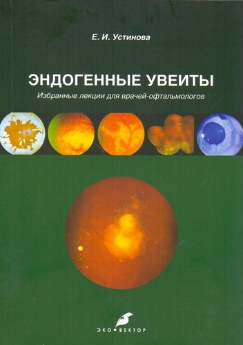 Эндогенные увеиты. Избранные лекции для врачей офтальмологов