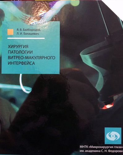 Хирургия патологии витрео-макулярного интерфейса