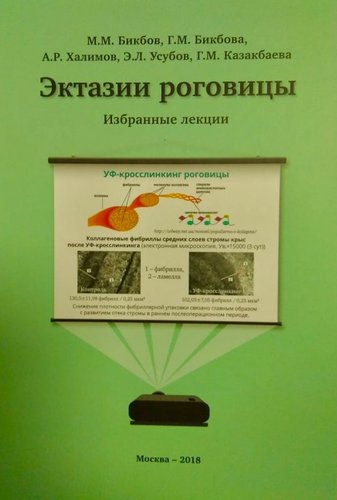 Эктазии роговицы. Избранные лекции