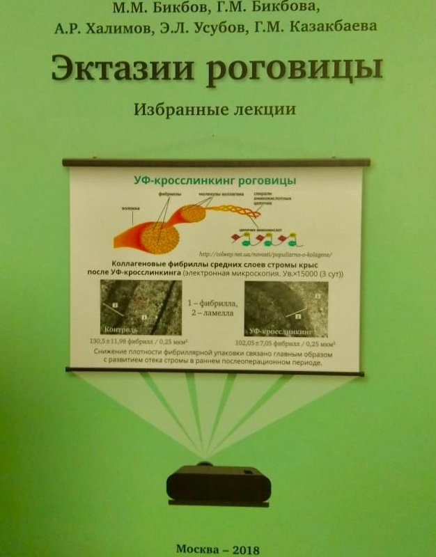 Эктазии роговицы. Избранные лекции