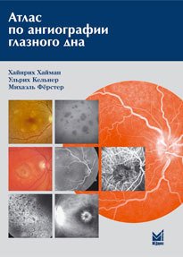 Атлас по ангиографии глазного дна