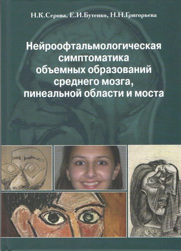 Нейроофтальмологическая симптоматика объемных образований среднего мозга, пинеальной области и мост