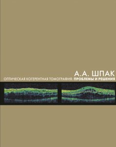 Оптическая когерентная томография: проблемы и решения