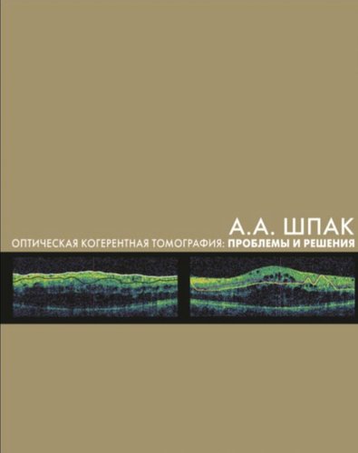 Оптическая когерентная томография: проблемы и решения