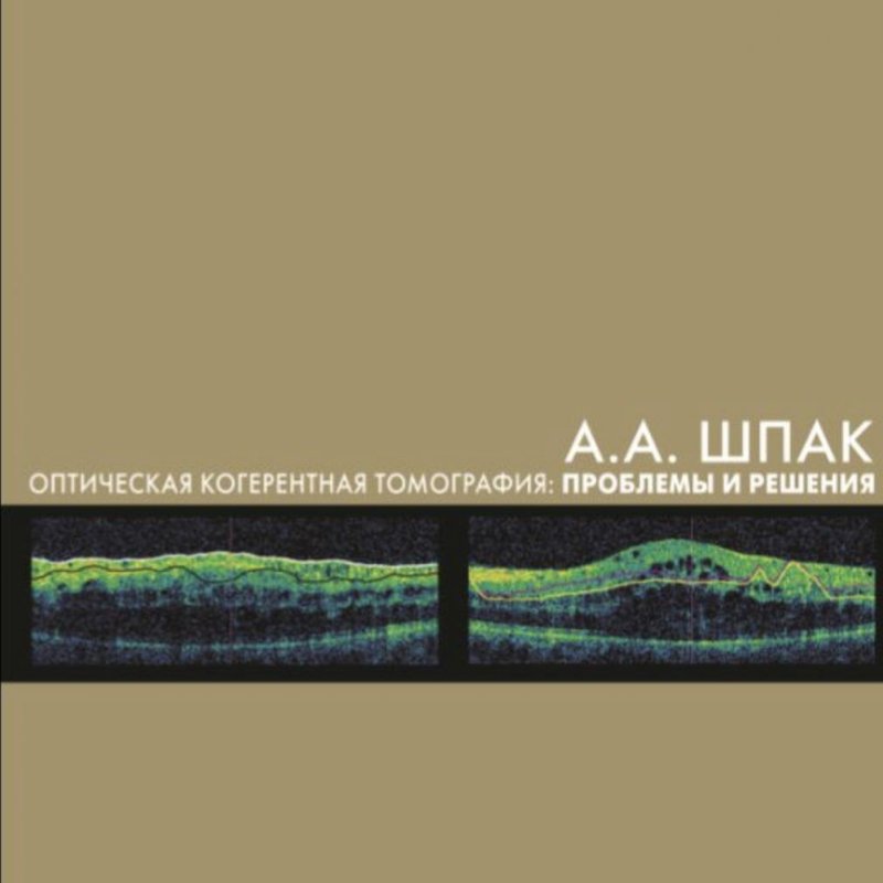 Оптическая когерентная томография: проблемы и решения