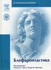 Блефаропластика+DVD