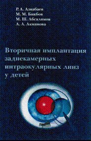 Вторичная имплантация заднекамерных интраокулярных линз у детей.