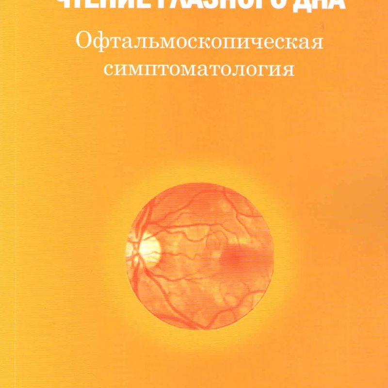 Чтение глазного дна. Офтальмологическая симптоматология