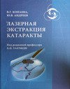 Лазерная экстракция катаракты.