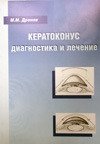 Кератоконус: диагностика и лечение.