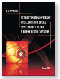 Ретинотомографические исследования диска зрительного нерва в норме и при глаукоме.
