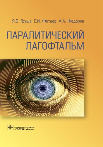 Паралитический лагофтальм