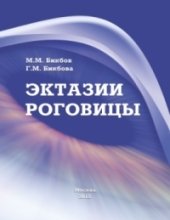 Эктазии роговицы