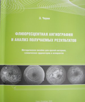 Флюоресцентная ангиография и анализ получаемых результатов