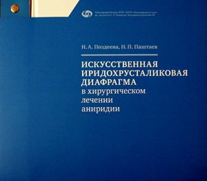 Искусственная иридохрусталиковая диафрагма в хирургическом лечении аниридии