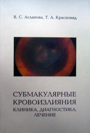 Субмакулярные кровоизлияния: клиника, диагностика, лечение