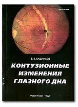Контузионные изменения глазного дна