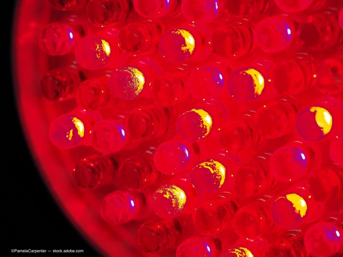 Коммерческие устройства для красного света при близорукости могут превышать безопасные уровни