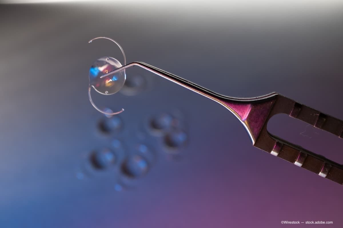 Персонализированный подбор интраокулярных линз начинается с ожиданий пациента