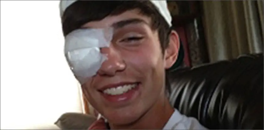 Подросток лишился зрения на один глаз из-за фейерверка